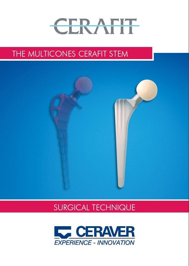 HAC CERAFIT STEM Surgical Technique Ceraver